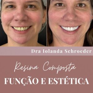 E-book Função e Estética